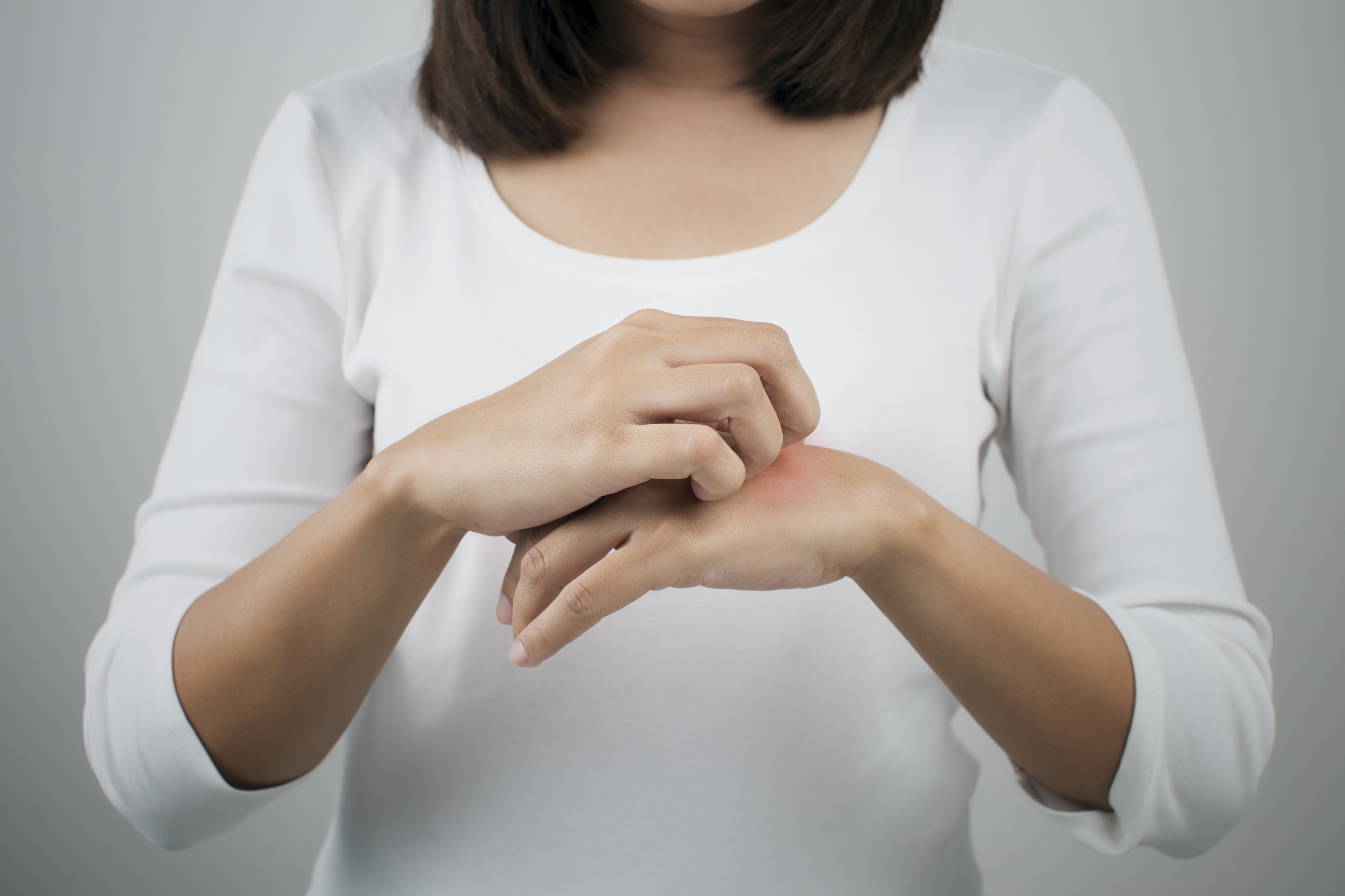 A Woman Itching The Back Of Her Hand